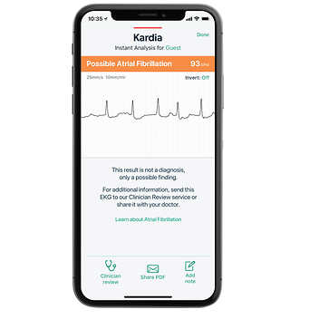 KardiaMobile - Personal ECG with Carry Pod